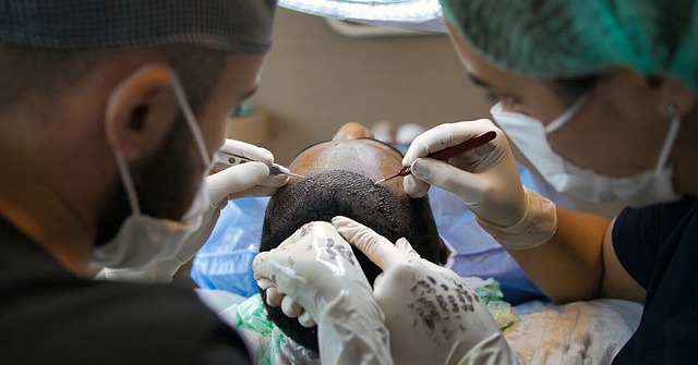 De nyeste fremskridt inden for hårtransplantationer for mænd